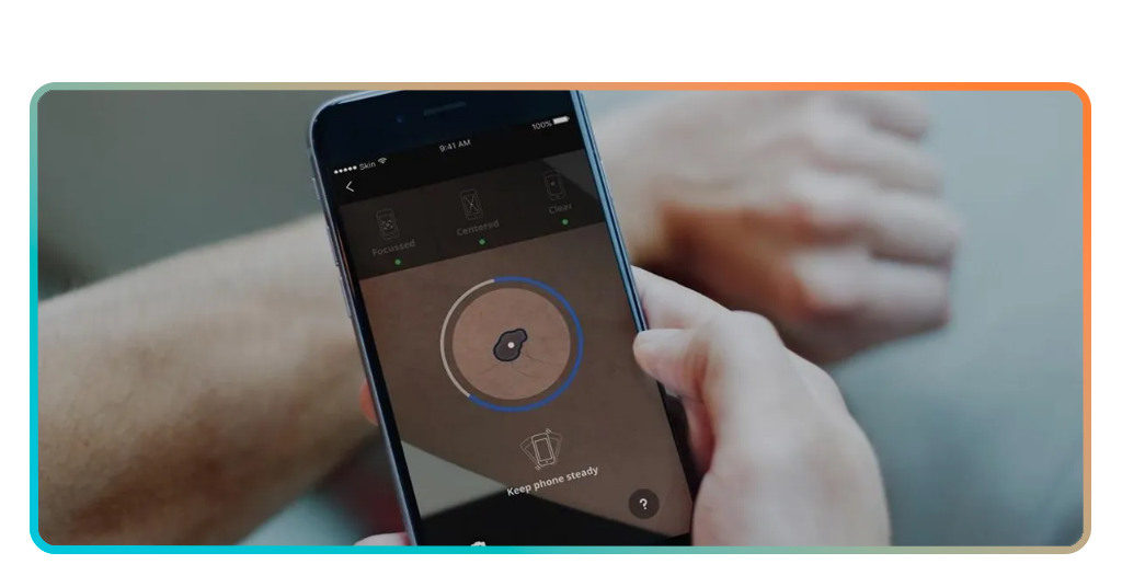 Skin Spot Monitor: Track Irregularities With Smart Photo Analysis 1 Skin Spot Monitor