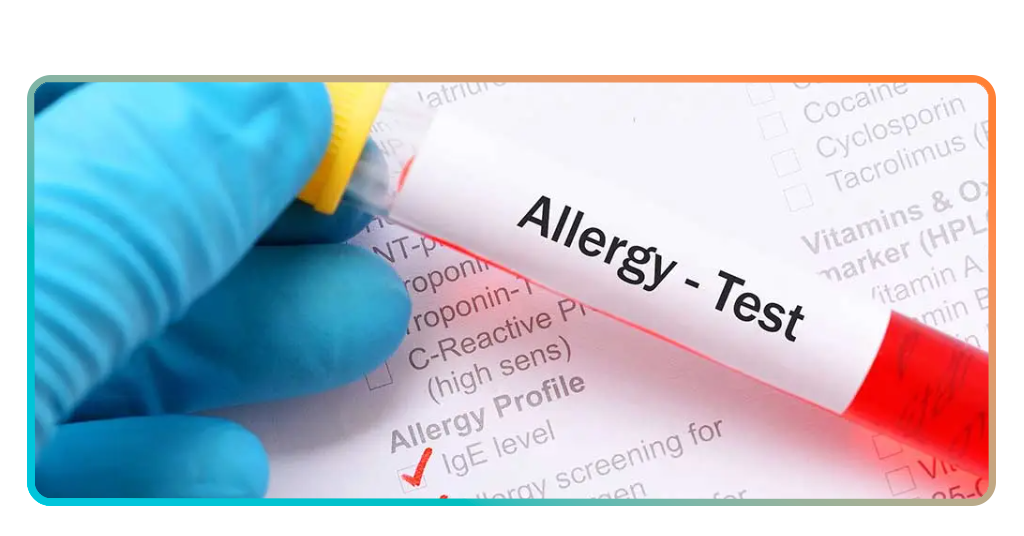 Lab blood test results from an at-home allergy test kit