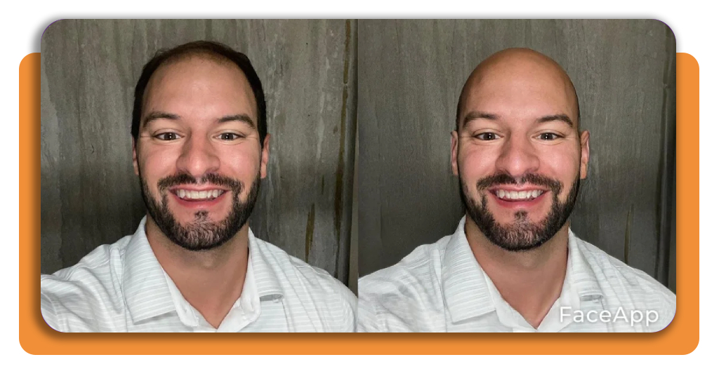 Bald filter app: see how you would look if you were bald 5 IMG 7321 04